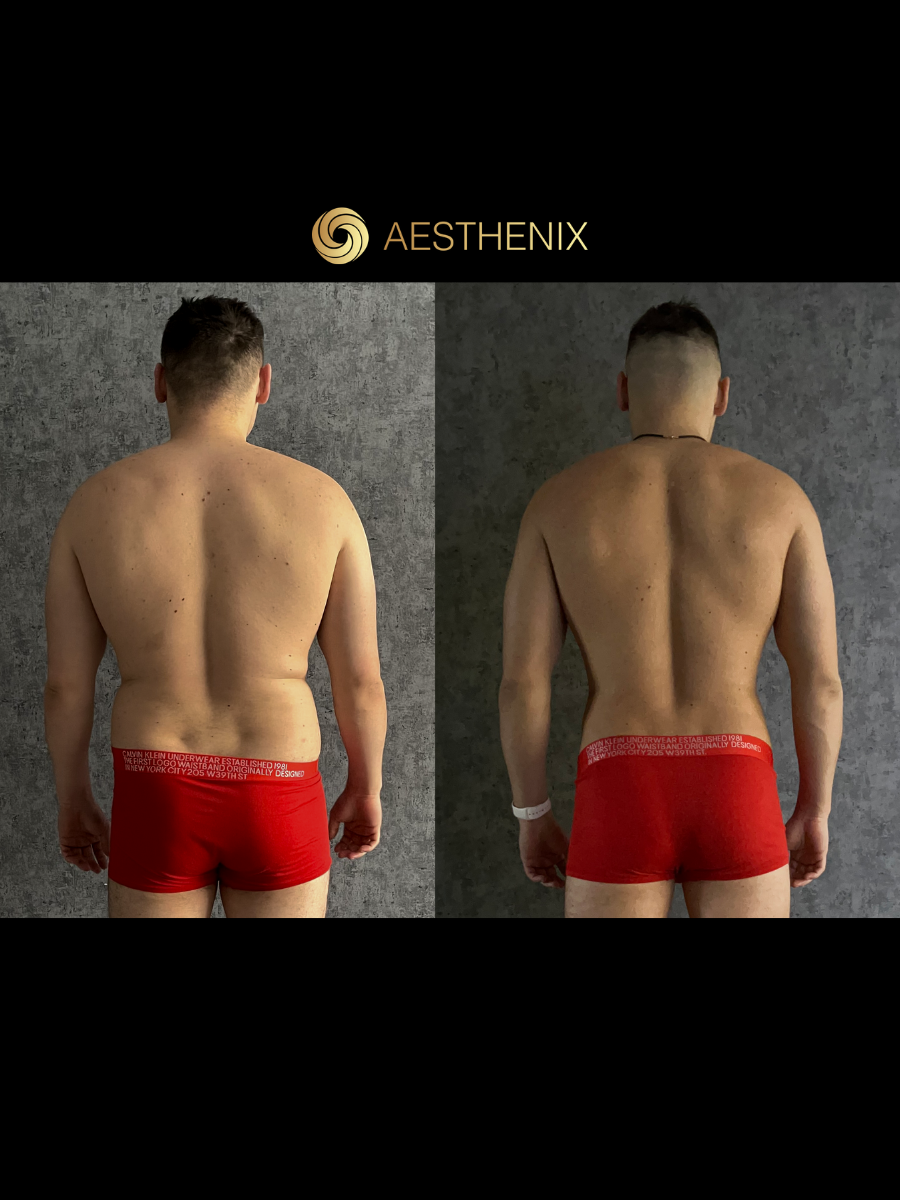 Андрей Захаров после